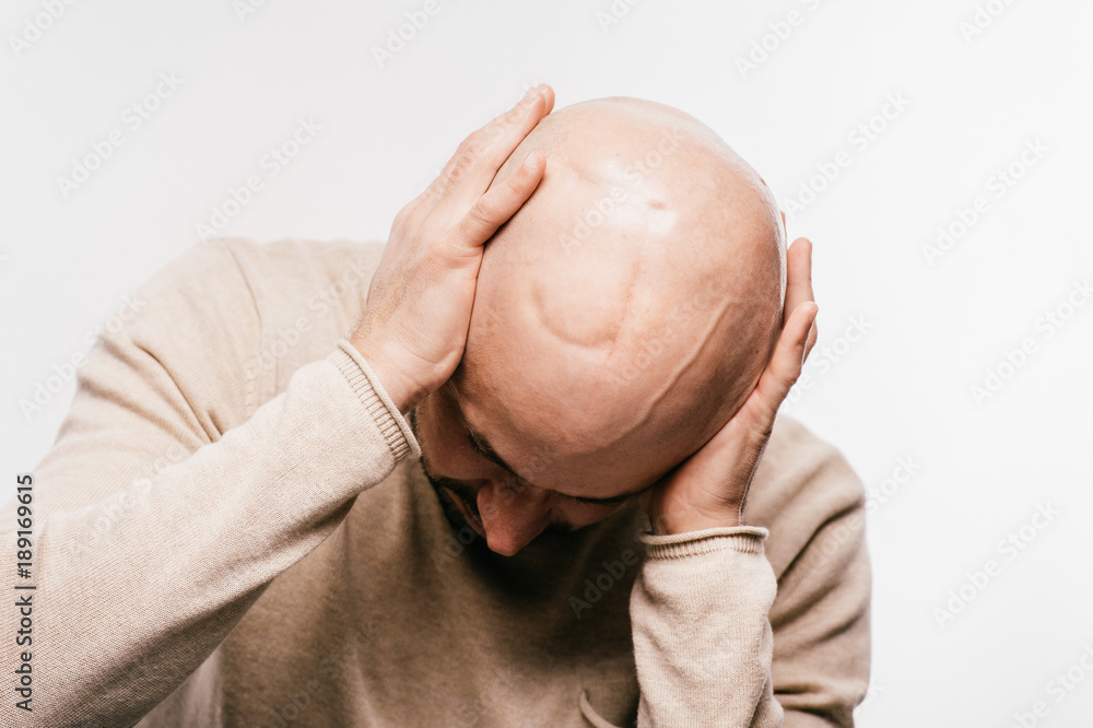 Naklejka premium Bald man psychological stress struggling for life arter brain tumor. Heartbreaking male emotions after cancer neurosurgery operation. Oncology survivor patient. Chemotherapy and irradiation head marks