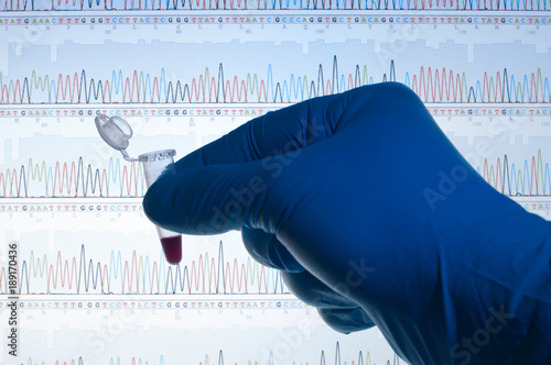 DNA Test