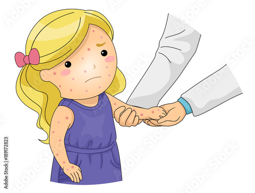 Kid Girl Chicken Pox Check Up Illustration