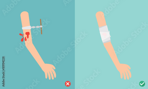 wrong and right ways first aid emergency treatment,illustration