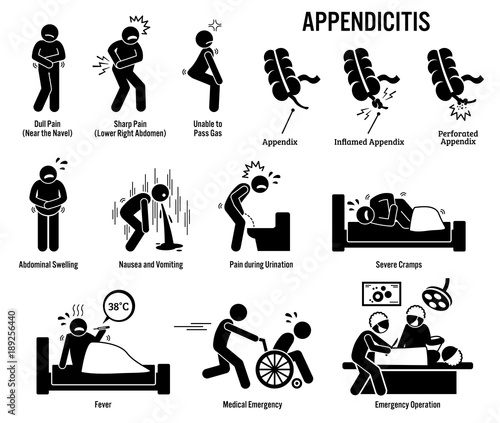 Appendix and Appendicitis Icons. Pictogram and diagrams depict signs, symptoms, and emergency surgery of a appendicitis patient in surgery room. 