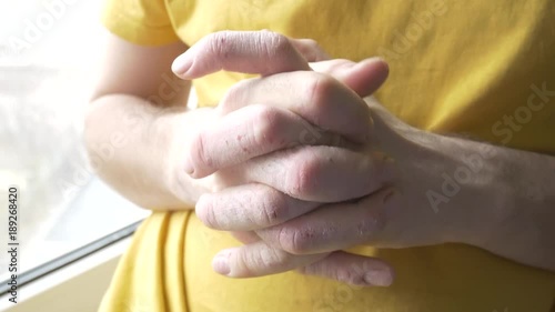 man with sick hands near the window photo