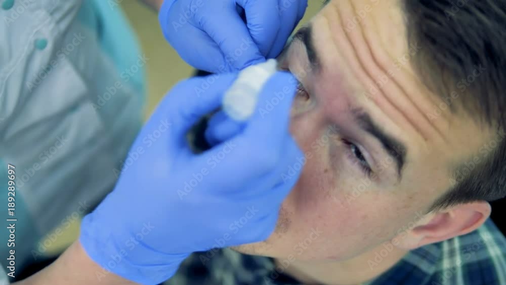 A young man gets some medicine dropped into his eyes by an optician. 4K. A young man gets some medicine dropped into his eyes by an optician. 4K.