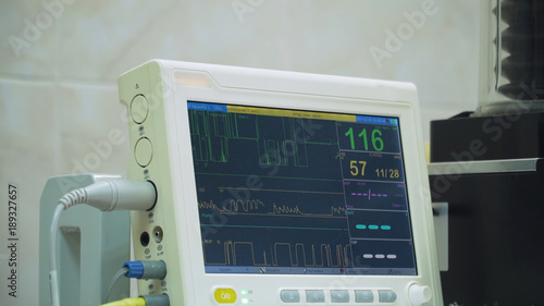 Electrocardiogram in hospital surgery operating theater emergency room showing patient heart rate. Monitoring patient's vital sign in operating room. Cardiogram monitor during surgery in operation