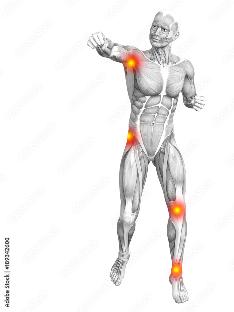 Conceptual human muscle anatomy with red and yellow hot spot inflammation or articular joint pain for health care therapy or sport concepts. 3D illustration man arthritis or bone osteoporosis disease