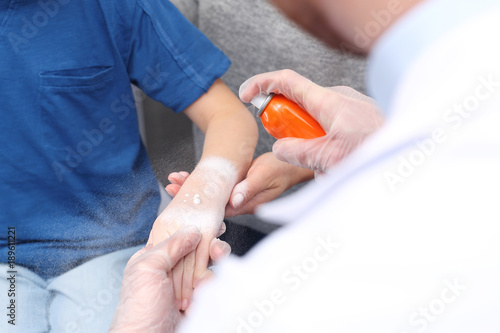 Oparzenie, pierwsza pomoc. Lekarz nakłada piankę na oparzoną rękę dziecka