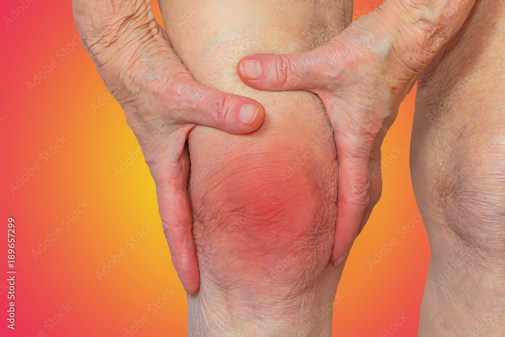 Senior woman holding the knee with pain Senior woman holding the knee with pain