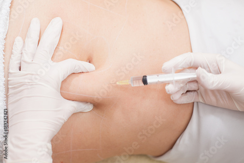 mesotherapy treatment on woman s body