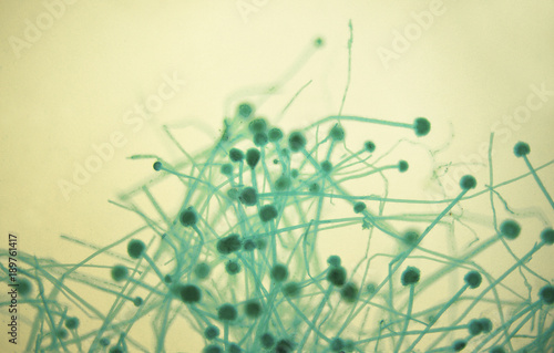 Aspergillus under microscope 