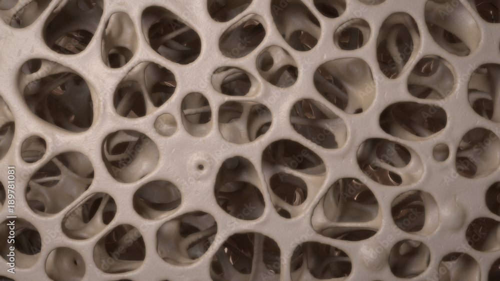 3D CG rendered image of osteoporosis bone micro structure 3D CG rendered image of osteoporosis bone micro structure