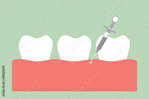 dental injection for tooth extraction, syringe and anesthetizing