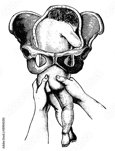 Geburt Anatomie Beckenendlage (historisch) - Birth anatomy breech end position (historical)