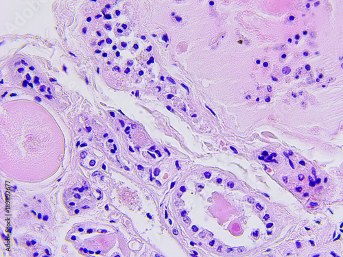 Fotografija Human tissue microscopic photography