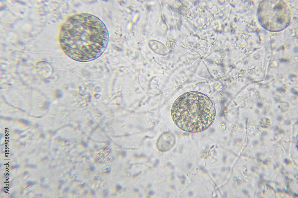 custom made wallpaper toronto digitalChlamydomonas algae, paramecium ciliates and many bacteria through microscope