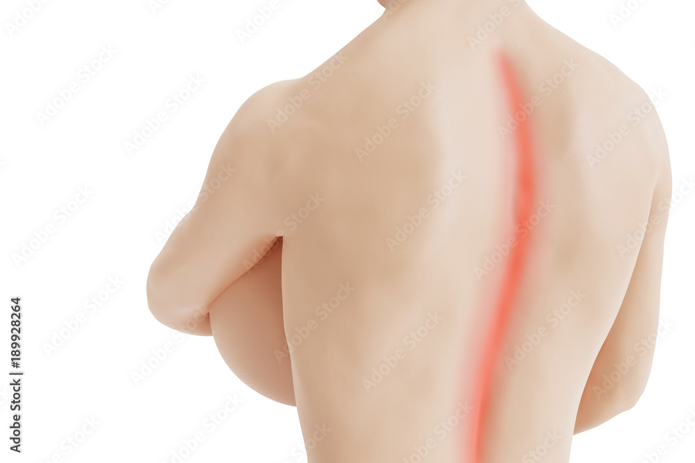 Back pain concept - Beautiful nude woman with huge boobs has back