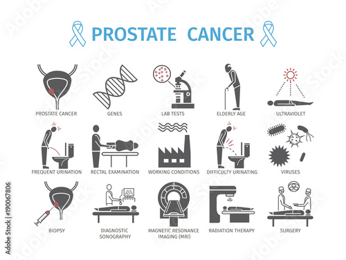 Prostate Cancer. Symptoms, Causes. Diagnostics. Flat icons set. Vector infographics.