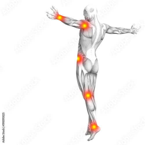 Conceptual human muscle anatomy with red and yellow hot spot inflammation or articular joint pain for health care therapy or sport concepts. 3D illustration man arthritis or bone osteoporosis disease