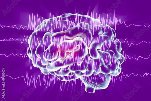 Canvas-taulu Epilepsy awareness concept