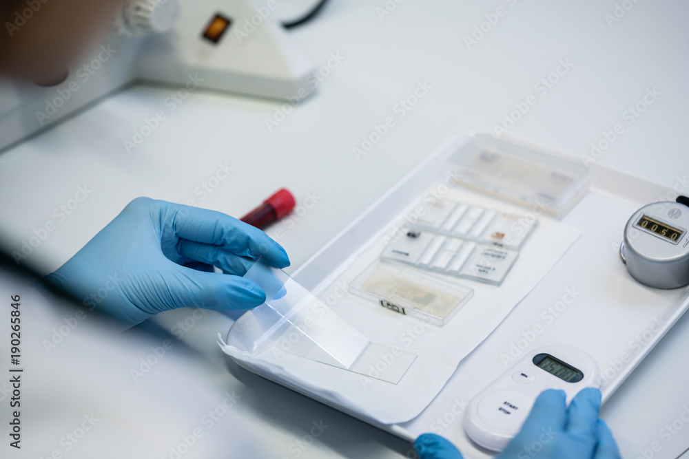 Close up of lab technician preparing medical or scientific blood test