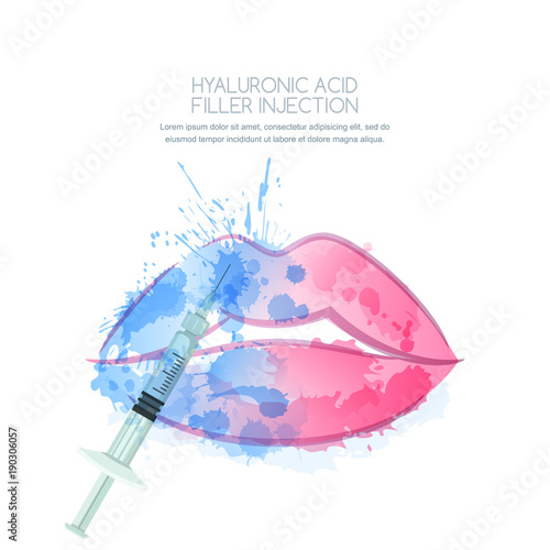 Vector illustration of hyaluronic acid filler injections or mesotherapy procedures. Watercolor female lips and syringe in water splashes. Cosmetology moisturizing procedures and beauty concept.