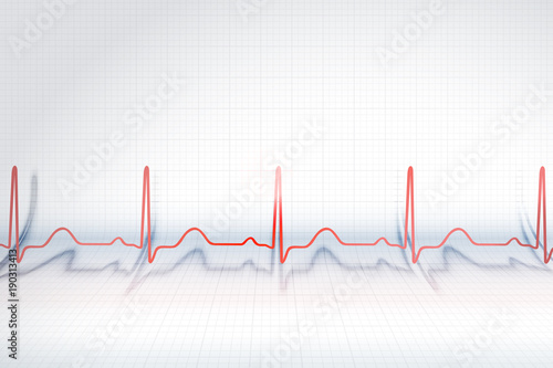 Red line of ECG chart on the background of plotting paper, vector illustration