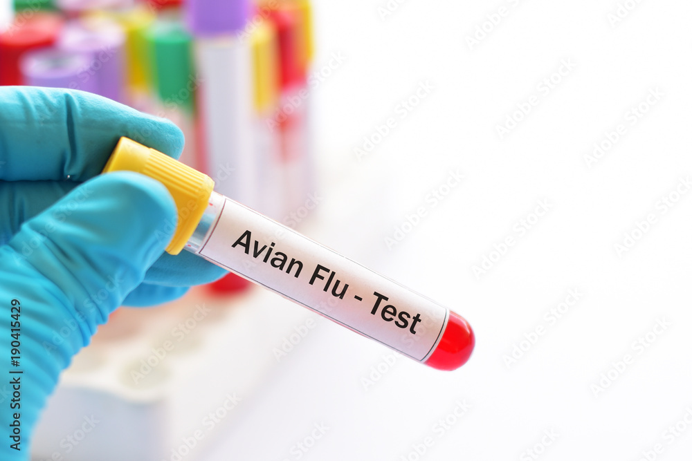 Obraz premium Test tube with blood sample for Avian influenza virus test