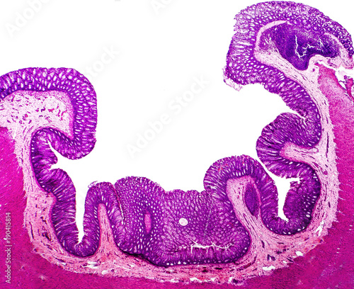 Histology of human appendix, cross-section, micrograph showing epithelium and Crypts of Lieberkuhn. Photo under microscope, isolated on white background photo