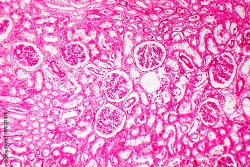 Histology of human kidney, light micrograph showing nephrons. Microscopy, hematoxylin and eosin staining photo