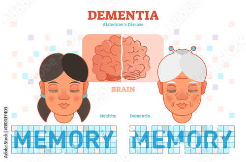 Dementia or alzheimer's disease concept vector illustration diagram with young and old woman. 