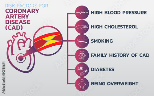Ischemic heart disease, Ischemic Cardiomyopathy, coronary artery disease (CAD) icon design, infographic health, medical infographic. Vector illustration