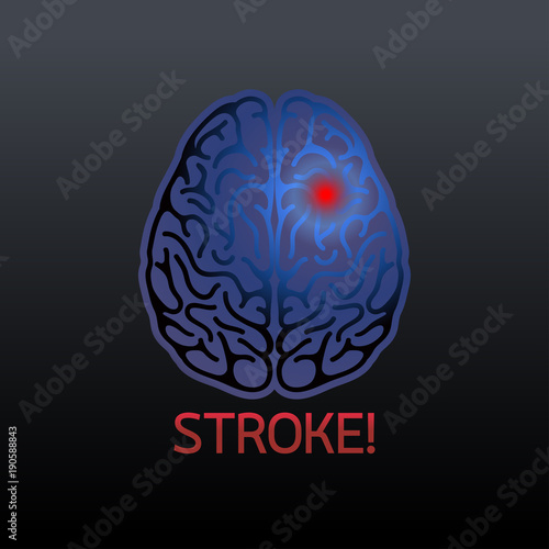 Brain stroke vector illustrator