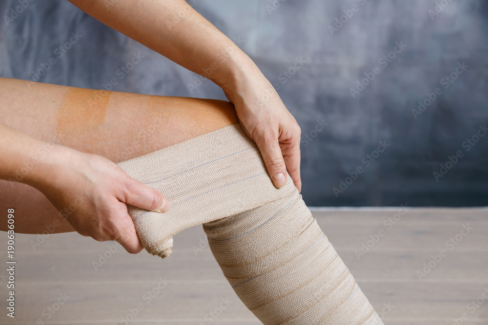 Application of elastic compression bandage