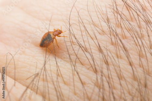 Bed bug on the human body in a macro