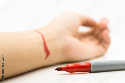 Red pen write down the wrist. Image use for Major depressive disorder  health concept.