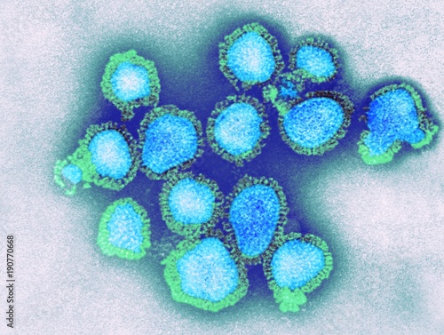 H3N2 influenza virus particles, TEM photo