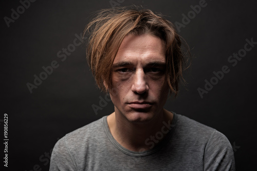 Portrait of exhausted sad guy with shaggy hair standing and looking at camera with apathy. Isolated on background