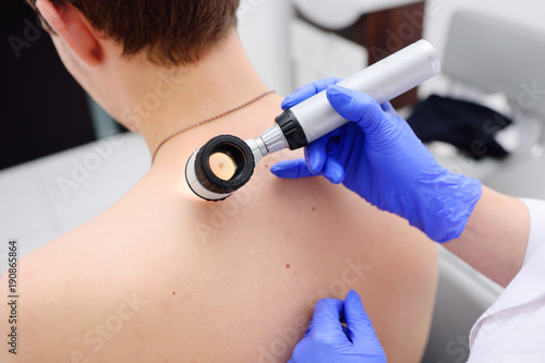 the doctor dermatologist examines birthmarks and birthmarks of the patient with a dermatoscope. Preventive maintenance of a melanoma photo