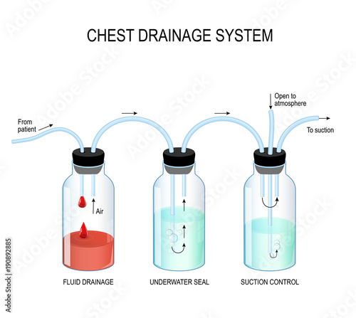 Chest drainage system