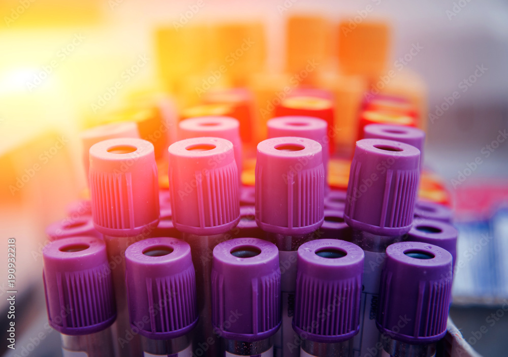 Empty tubes. Background . Medical equipment. Empty tubes. Background . Medical equipment.