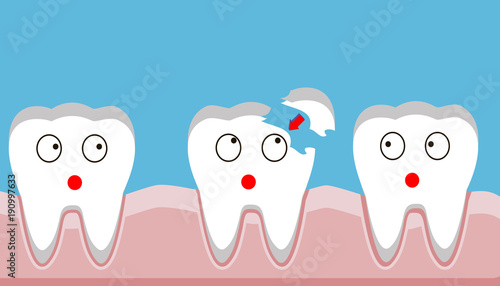 tooth fracture, filling, teeth, trauma, vector 