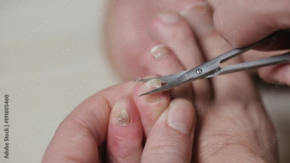 Man cutting toenails with scissors. Male cut toenails on foot. Toenails