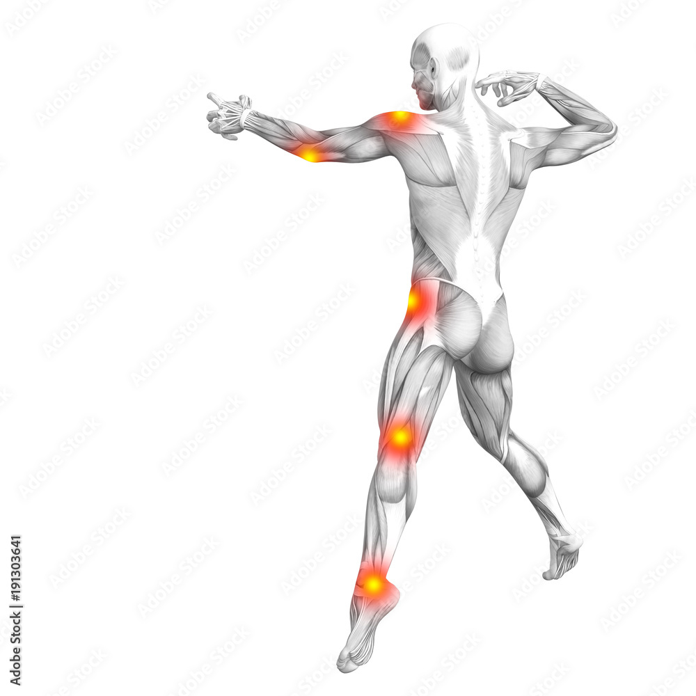 Conceptual human muscle anatomy with red and yellow hot spot inflammation or articular joint pain for health care therapy or sport concepts. 3D illustration man arthritis or bone osteoporosis disease Conceptual human muscle anatomy with red and yellow hot spot inflammation or articular joint pain for health care therapy or sport concepts. 3D illustration man arthritis or bone osteoporosis disease