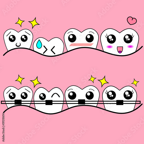 Cartoon tooth braces. Vector illustration