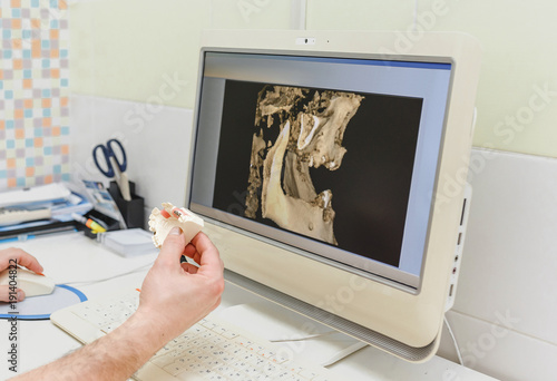 Dentist looks at jaw model and skull X-rays at computer monitor in clinic, tooth treatment and implantation concept photo