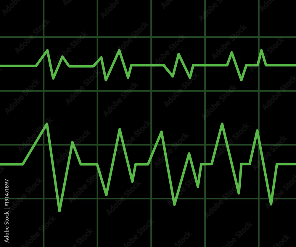 vector illustration of green heart line cardiogram