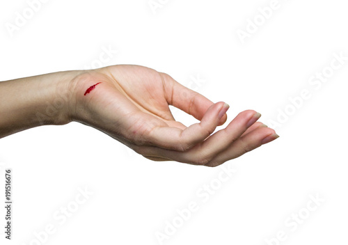 Vászonkép hand with a cut
