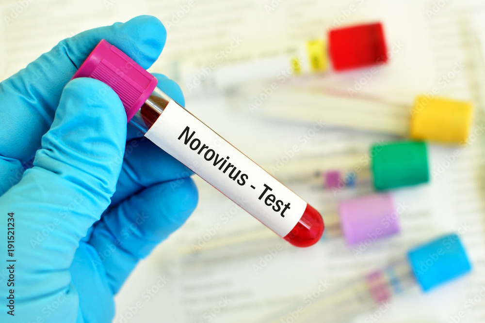 Fototapeta premium Test tube with blood sample for Norovirus test