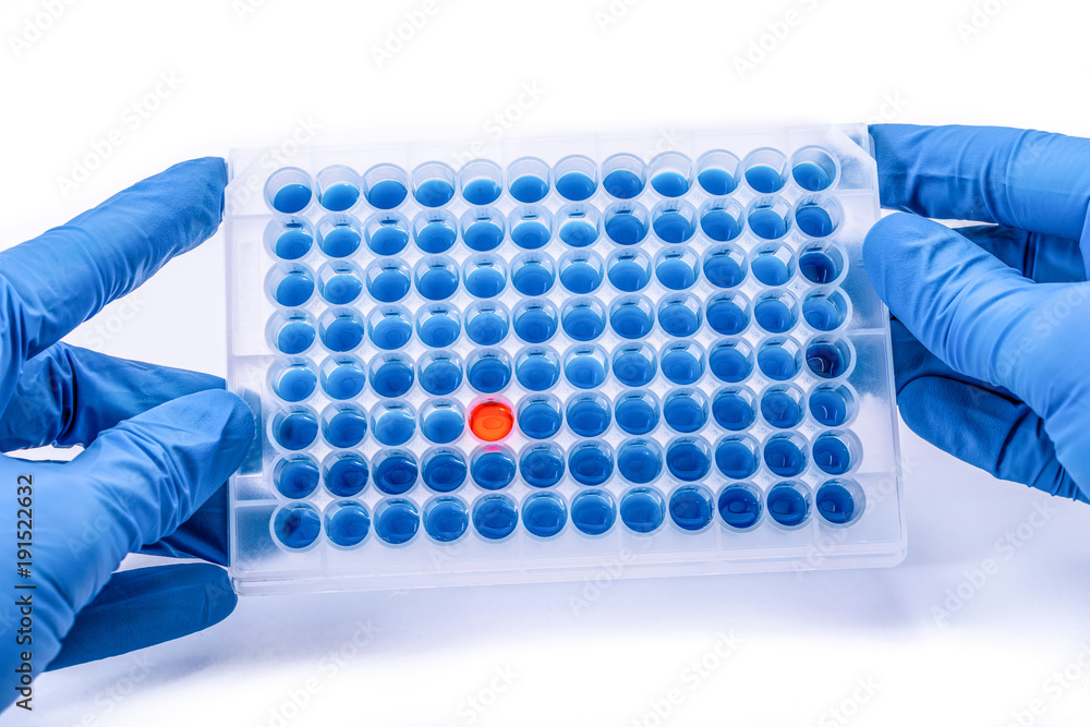 Laboratory test plate. hands with 96 well microplate. medical or microbiological test of blood or dna. test of cancer or virus