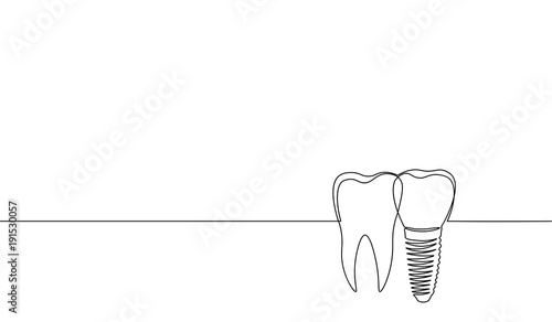 Single continuous line art anatomical human tooth silhouette implant. Healthy medicine recovery molar root cavity concept design world oral health day one sketch outline drawing vector illustration