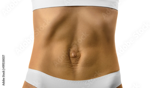 Diastasis recti. Woman's abdomen divergence of the muscles of the abdomen after pregnancy and childbirth. photo